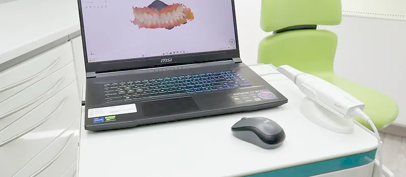 Intraoralscanner für digitale Abformung